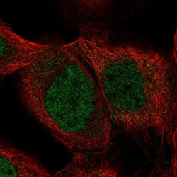 SHQ1 Antibody, Novus Biologicals 25 &mu;L | Buy Online | Novus Biologicals | Fisher Scientific